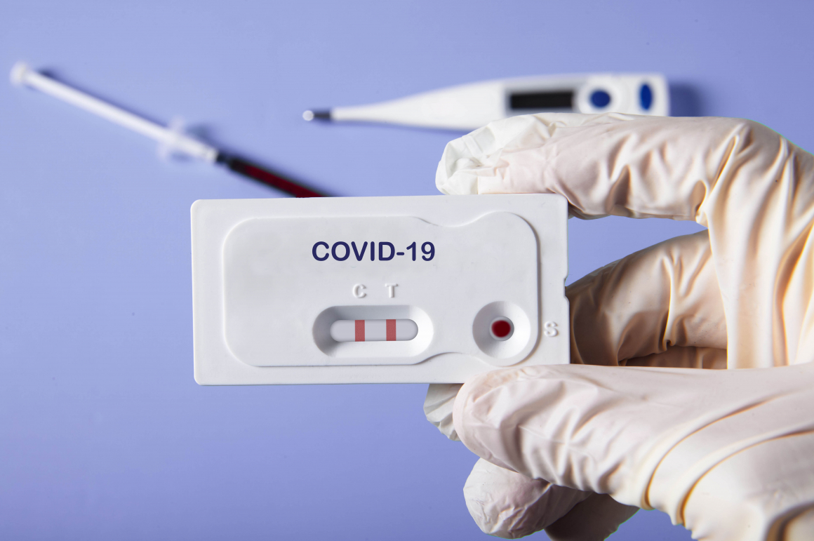 Coronavirus : les autotests ne sont plus interdits